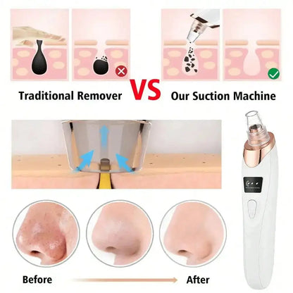 Blackhead Remover, Pore Vacuum Acne Cleaner/ Black Spots Removal Facial Deep  4.5   2 Reviews   ౹   50 sold Shelflex